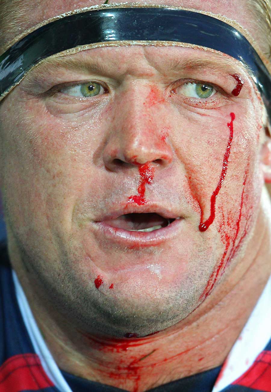 Blood runs down the face of Rebels prop Greg Somerville 