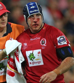 Reds prop Ben Daley leaves the field with an injury, Reds v Waratahs, Super Rugby, Suncorp Stadium, Brisbane, Australia, April 23, 2011