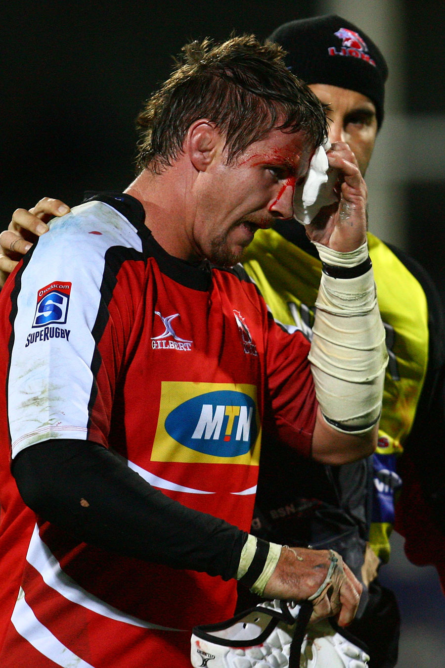 Lions lock Wikus van Heerden goes off for some treatment to a head wound