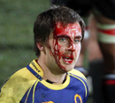 A bloodied Sean Romans leaves the field 