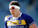 Bay of Plenty's Culum Retallick is left bloodied after a collision