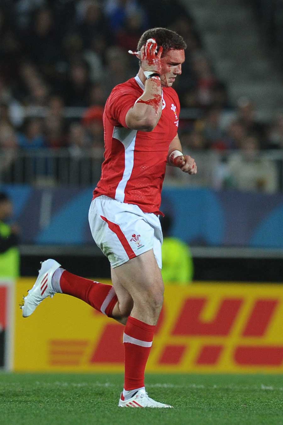 Wales' George North is forced off with blood