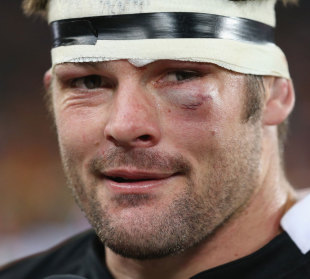 A bruised and battered All Blacks captain Richie McCaw, South Africa v New Zealand, Rugby Championship, FNB Stadium, Johannesburg, South Africa, October 6, 2012