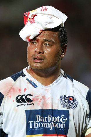 Auckland's Steven Luatua leaves the field with a head injury, Canterbury v Auckland, ITM Cup Premiership Final, AMI Stadium, Canterbury, New Zealand, October 27, 2012