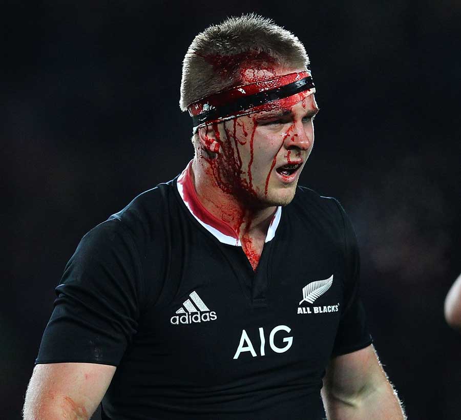 New Zealand's Sam Cane shows off his battle scars