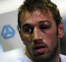Chris Robshaw is battered and bruised after England's defeat to New Zealand 
