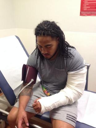 Ma'a Nonu after surgery for his broken arm, September 15, 2014
