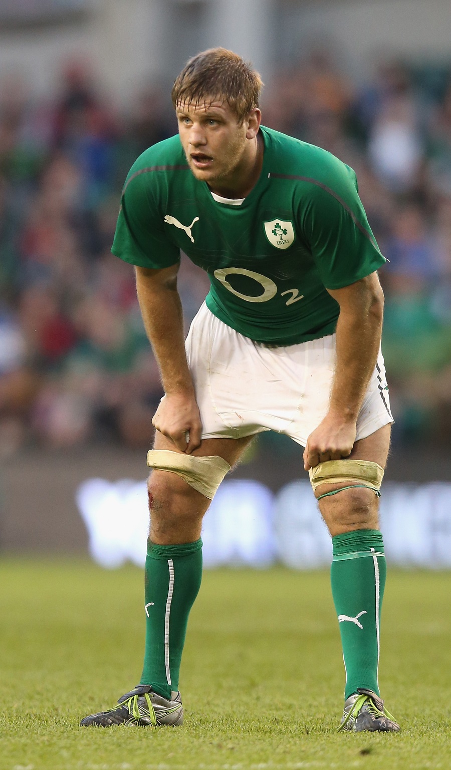 Ireland's Chris Henry underwent exploratory surgery on Monday after suffering a blocked blood vessel in his brain