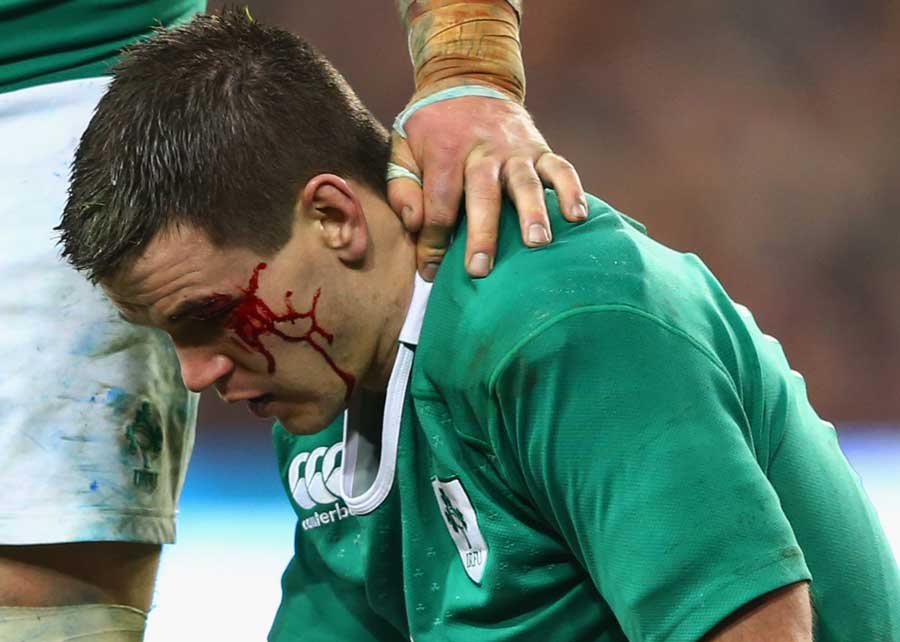 Ireland's Johnny Sexton takes a blow to the head