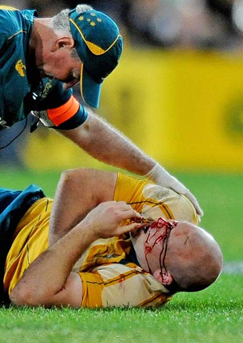 Australia's Stephen Moore receives treatment after a blow to the head