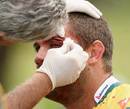 Australia's Matt Hodgson receives treatment for a cut